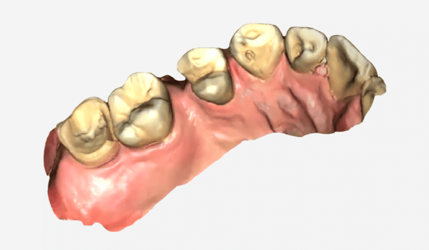 耘禾牙醫-3D齒雕