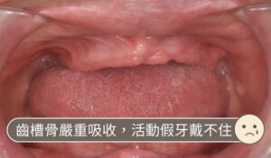 耘禾牙醫 – 多顆牙齒需要治療