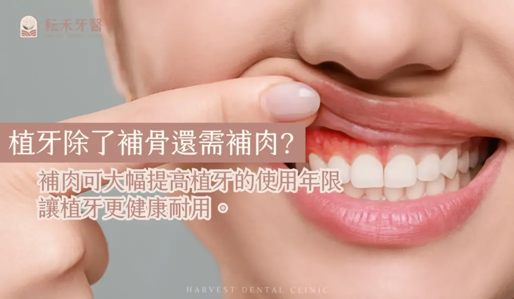 耘禾牙醫-補肉手術
