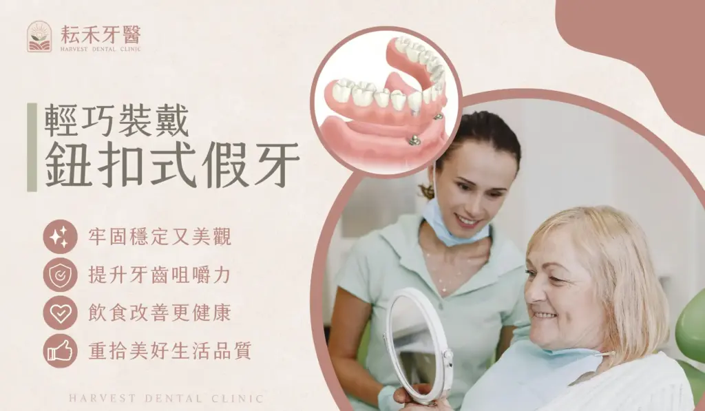 耘禾牙醫-鈕扣式假牙